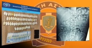 Σύλληψη 22χρονου αλλοδαπού | Είχε καταπιεί 840 γραμμάρια κοκαΐνης