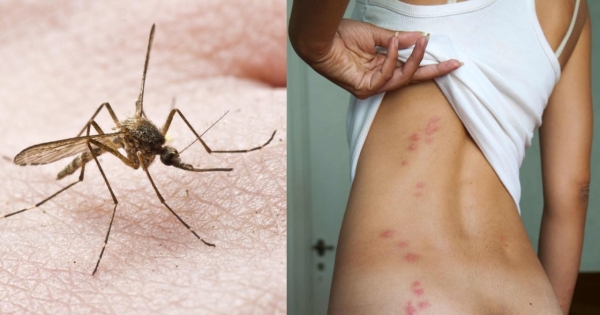 Γιατί τα κουνούπια τσιμπάνε μόνο εμένα; – Η ομάδα αίματος που… λατρεύουν – Τι συμβαίνει στο σώμα σας και τα έλκει περισσότερο