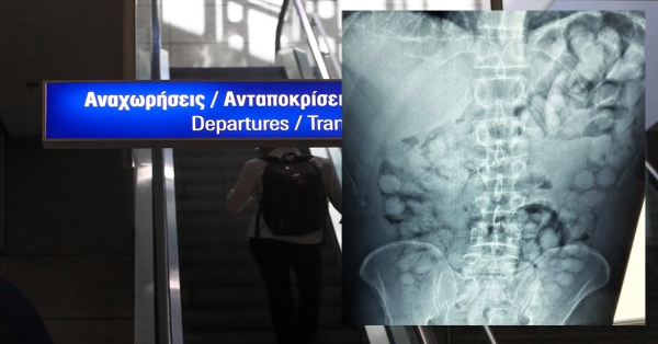 Συνελήφθη στην Αθήνα Βραζιλιάνος που είχε καταπιεί 100 «αυγουλάκια» κοκαΐνης