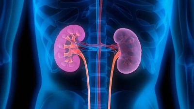 Παγκόσμια έκρηξη νεφρικής ανεπάρκειας απειλεί εκατομμύρια ανθρώπους