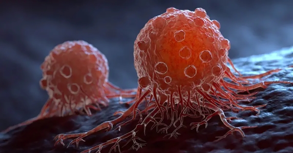 Ο καρκίνος εξελίσσεται σε παγκόσμια κρίση υγείας