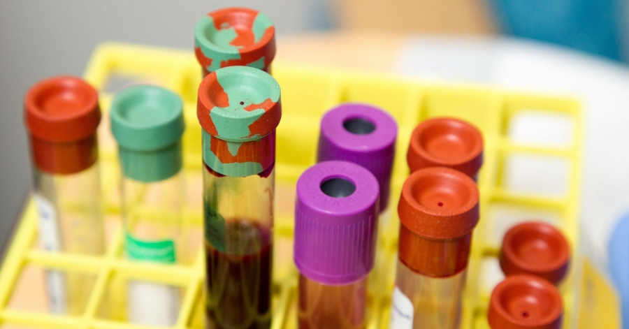 Λύθηκε μυστήριο 50 ετών για τις ομάδες αίματος - Τι αποκάλυψε νέα επιστημονική έρευνα