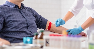 Απλές εξετάσεις αίματος μπορεί να είναι το μέλλον της διάγνωσης του καρκίνου