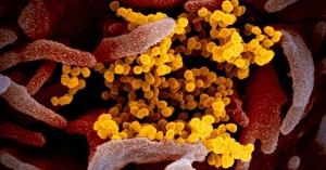 Ιός Νίπα: Ο κίνδυνος εξάπλωσης σε παγκόσμιο επίπεδο είναι χαμηλός, σύμφωνα με τον ΠΟΥ